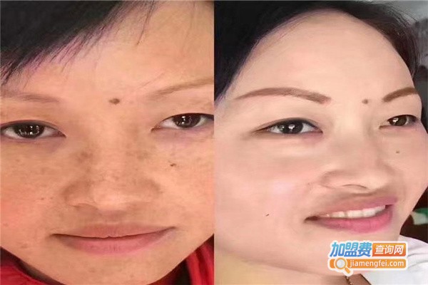 童颜堂祛斑重塑美丽脸庞的神奇之旅，最新评论与体验分享